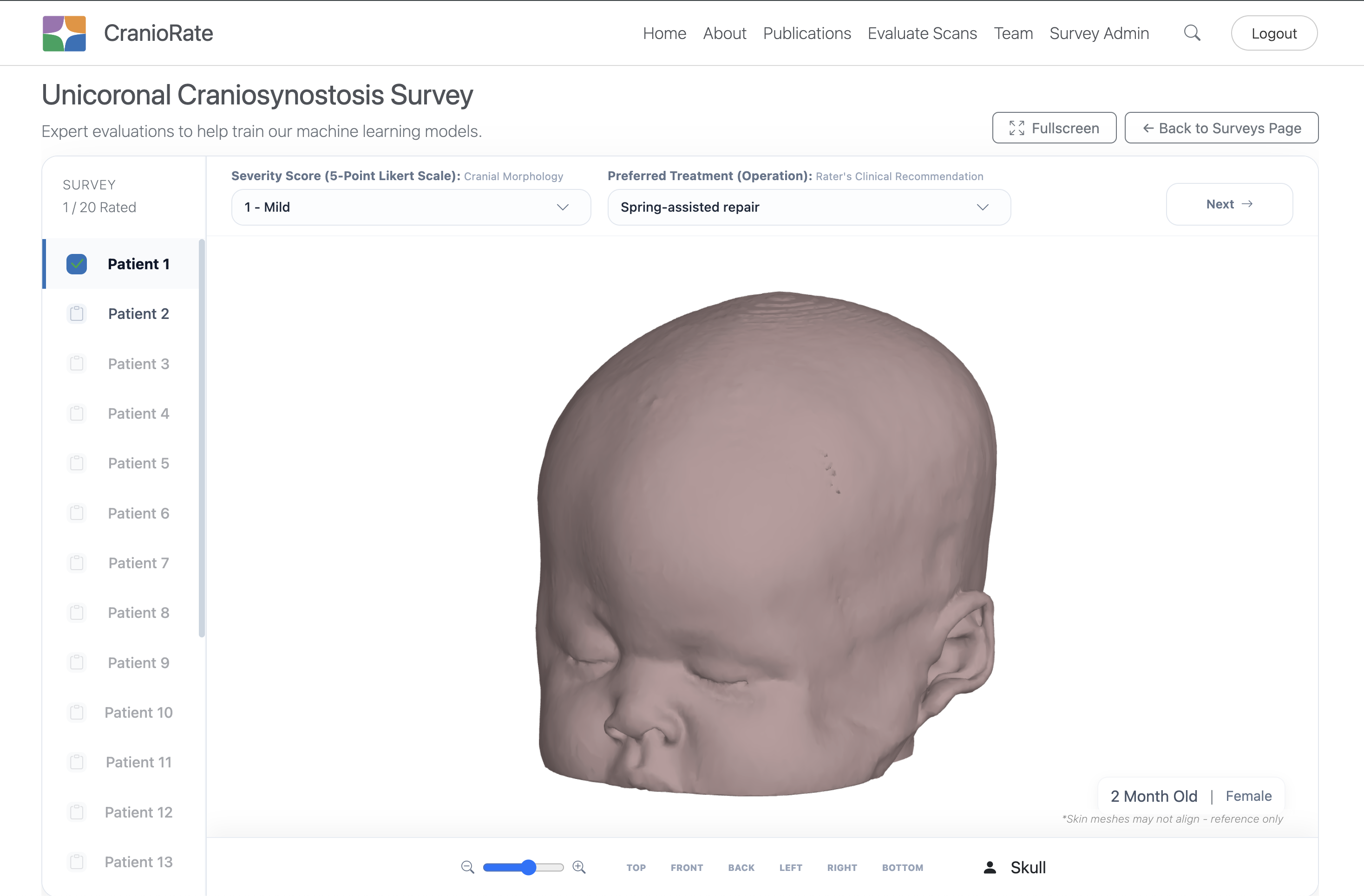 CranioRate survey interface